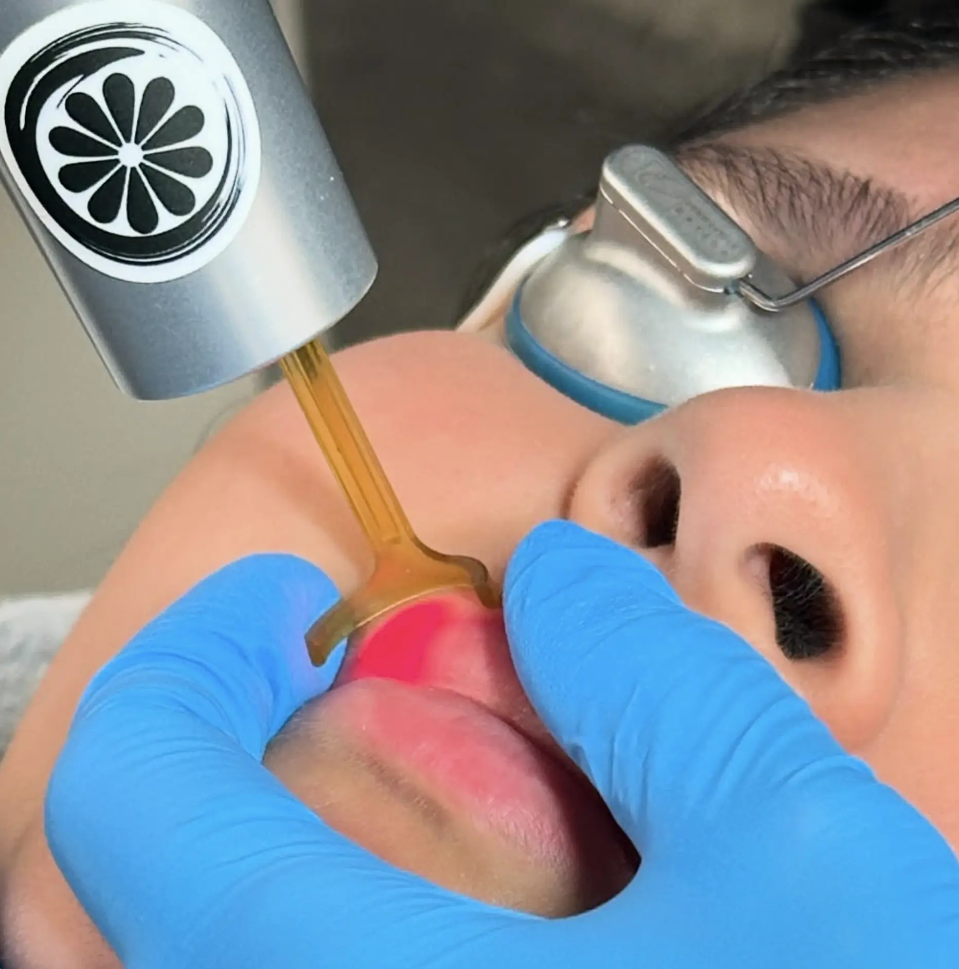 cosmetic tattoo removal