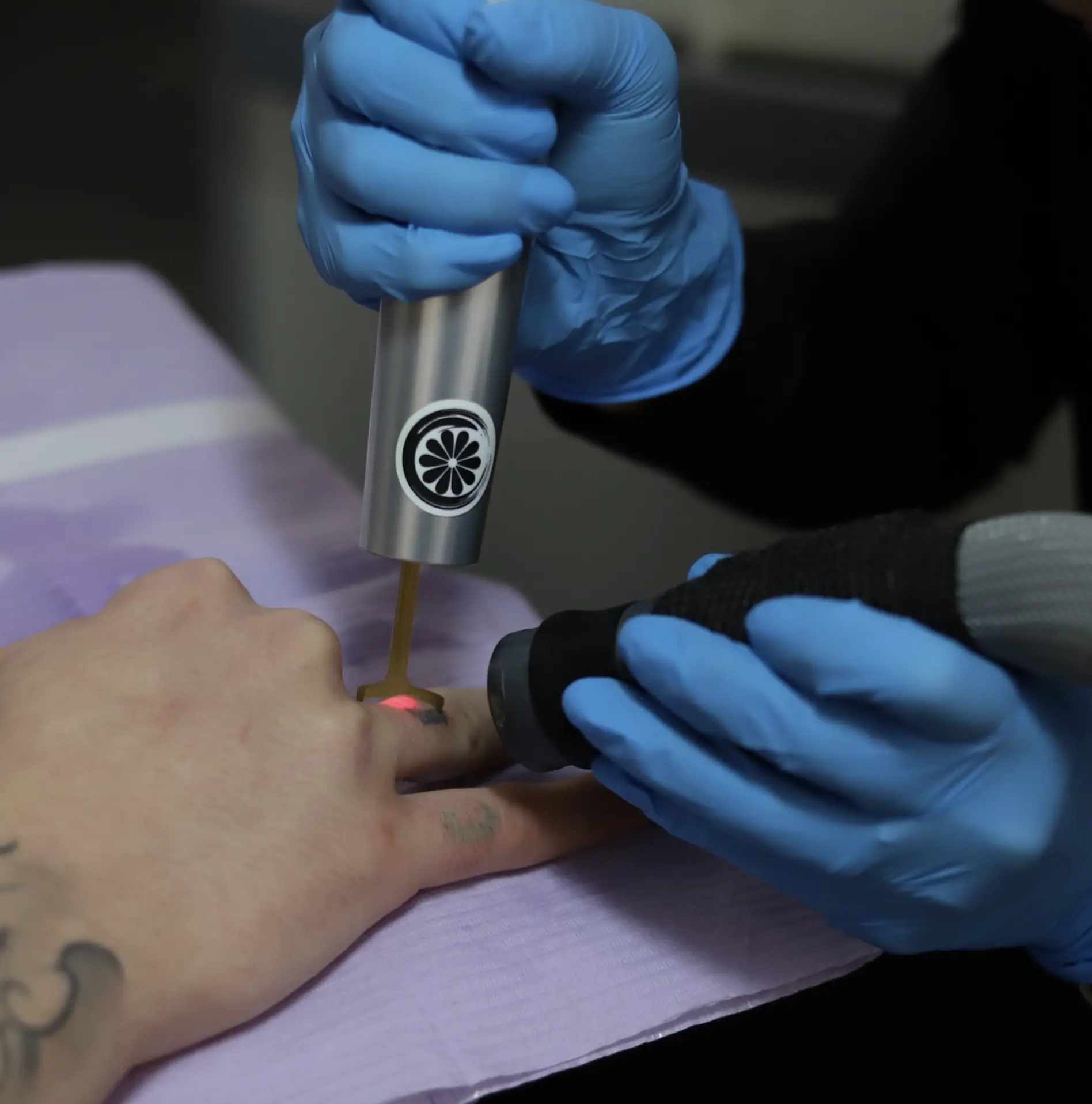 does tattoo removal leave scars