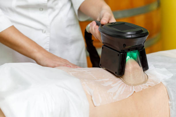 cool sculpting for weight loss