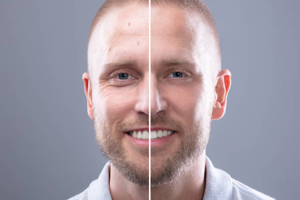 Discover the Magic of DermaFrac: A Radiant Skin Rejuvenation Journey