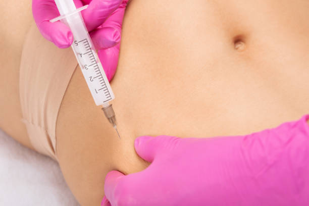 Fat Dissolving Injections: Side Effects & Essential Insights